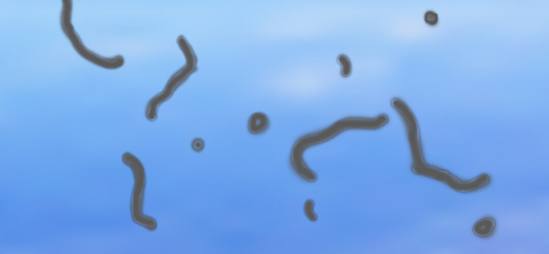 miodesopsias - Tu Optometrista